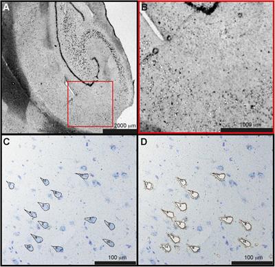 Microdissected Pyramidal Cell Proteomics of Alzheimer Brain Reveals Alterations in Creatine Kinase B-Type, 14-3-3-γ, and Heat Shock Cognate 71